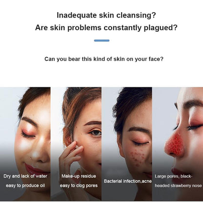 Blackhead Vacuum – Hot Compress & Deep Pore Cleanser