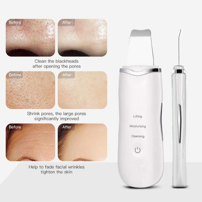 Ultrasonic 3-in-1 Facial Scrubber – Deep Pore Cleanser, Skin Lifter & Glow Booster