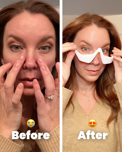 Merkvis LuminaRelief™ Eye Therapy Visor